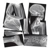 Roylco Broken Bones X-Ray Set, Projector Display Compatible, 15 X-Rays view 1
