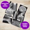 Roylco Broken Bones X-Ray Set, Projector Display Compatible, 15 X-Rays view 3