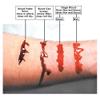 Graftobian Blood Gel 11 oz. Jar for Moulage & Special FX - Slowly Drips and Never Dries view 2