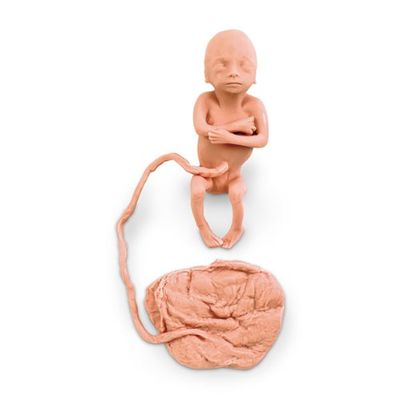 Fetus, 5 Months, Female