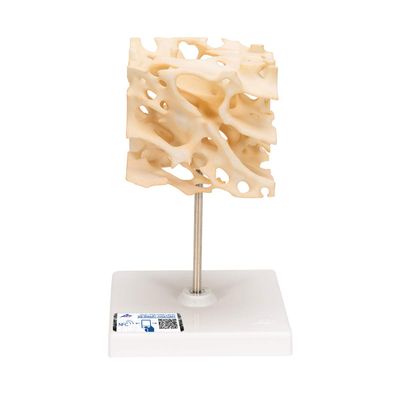 3B Scientific A99 Cancellous Bone (Trabecular/Spongy Bone) - 3B Smart Anatomy