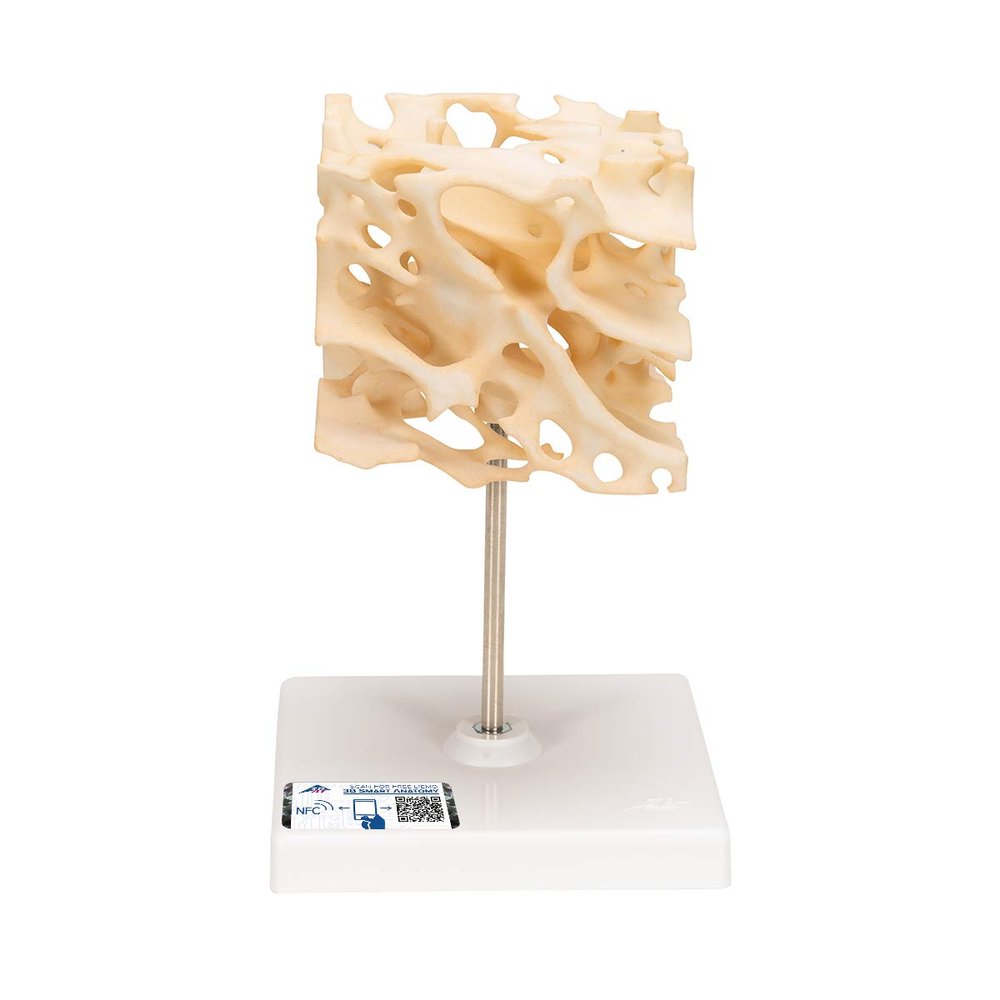 3B Scientific A99 Cancellous Bone (Trabecular/Spongy Bone) - 3B Smart Anatomy