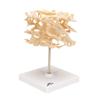 3B Scientific A99 Cancellous Bone (Trabecular/Spongy Bone) - 3B Smart Anatomy view 2