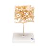 3B Scientific A99 Cancellous Bone (Trabecular/Spongy Bone) - 3B Smart Anatomy view 3