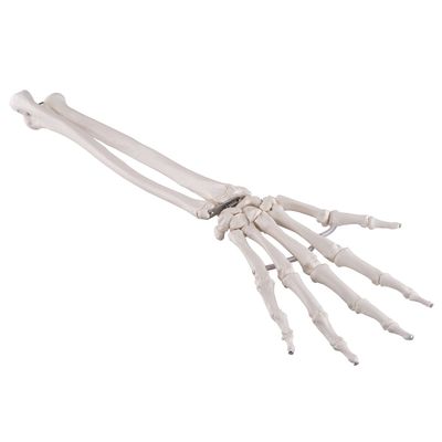 3B Scientific A40/3 Hand Skeleton w/Ulna-Radius loosely Strung - 3B Smart Anatomy