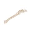 3B Scientific A41 Hand Skeleton w/portions of Ulna a. rad. Wire Mount - 3B Smart Anatomy view 3