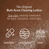 SKINBOSS Butt Acne Clearing Treatment & Luxe Loop Exfoliating Body Scrubber Targets Pimples, Folliculitis, Scars & Dark Spots Body Cream & Exfoliating Washcloth 5 oz Cream & Exfoliator (Black) view 2