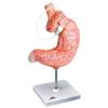 3B Scientific K15/1 Gastric Band Model - 3B Smart Anatomy view 1