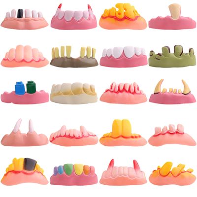 Megamix Funny Halloween Teeth - 100 Pack Random Style Fake Dentures for Adults Kids - Vampire Fangs, Hillbilly, Scary Monster Party Favors, Gags & Practical Joke Toys