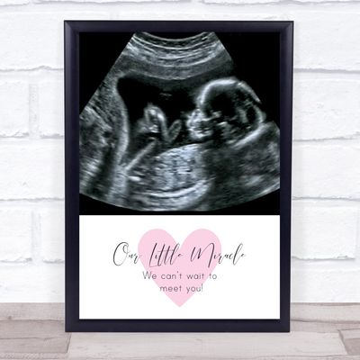 Baby Pregnancy Ultrasound Scan Photo Our Little Miracle Personalized Gift Print