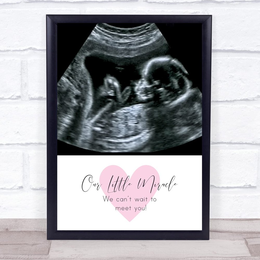 Baby Pregnancy Ultrasound Scan Photo Our Little Miracle Personalized Gift Print