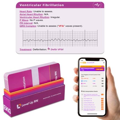 EKG Interpretation Flash Cards  for Nursing/EMT/Paramedic School  2026 NCLEX ATI HESI Review LPN RN Flash Cards (45 Cards)