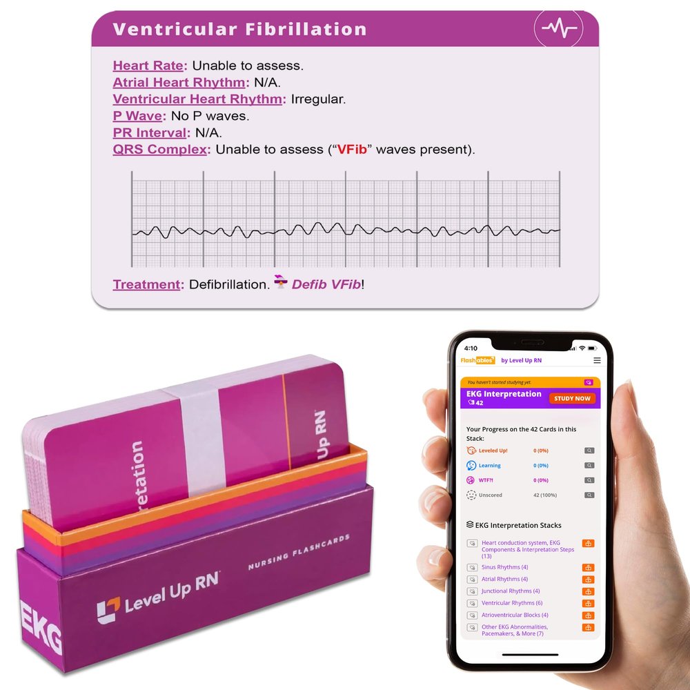 EKG Interpretation Flash Cards for Nursing/EMT/Paramedic School 2026 NCLEX ATI HESI Review LPN RN Flash Cards (45 Cards)