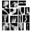 Sayglossy 15 Pcs Broken Bones x Ray Set Human x Rays Black and White Skeleton Pretend Xrays for Kids view 1