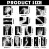 Sayglossy 15 Pcs Broken Bones x Ray Set Human x Rays Black and White Skeleton Pretend Xrays for Kids view 2