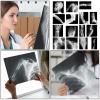 Sayglossy 15 Pcs Broken Bones x Ray Set Human x Rays Black and White Skeleton Pretend Xrays for Kids view 4