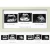 KeaBabies Baby Sonogram Picture Frames - Trio Ultrasound Picture Frames, First Time Mom Gift, Cute Pregnancy Reveal Photo Frame, Baby Gender Reveal Gift, Newborn Nursery Decor (Sage) view 1