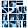 Sayglossy 15 Pcs Broken Bones x Ray Set Human x Rays Black and Blue Skeleton Pretend Xrays for Kids view 1