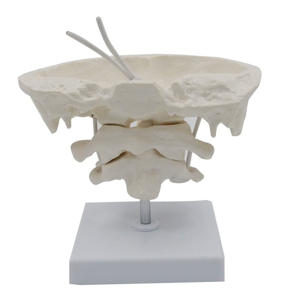 1.5X Occipital Bone with Base Doctor Office Anatomy Classroom Study Aid for Anatomy Class Includes Detailed Spine Models for Chiropractors