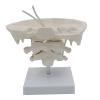 1.5X Occipital Bone with Base Doctor Office Anatomy Classroom Study Aid for Anatomy Class Includes Detailed Spine Models for Chiropractors view 1