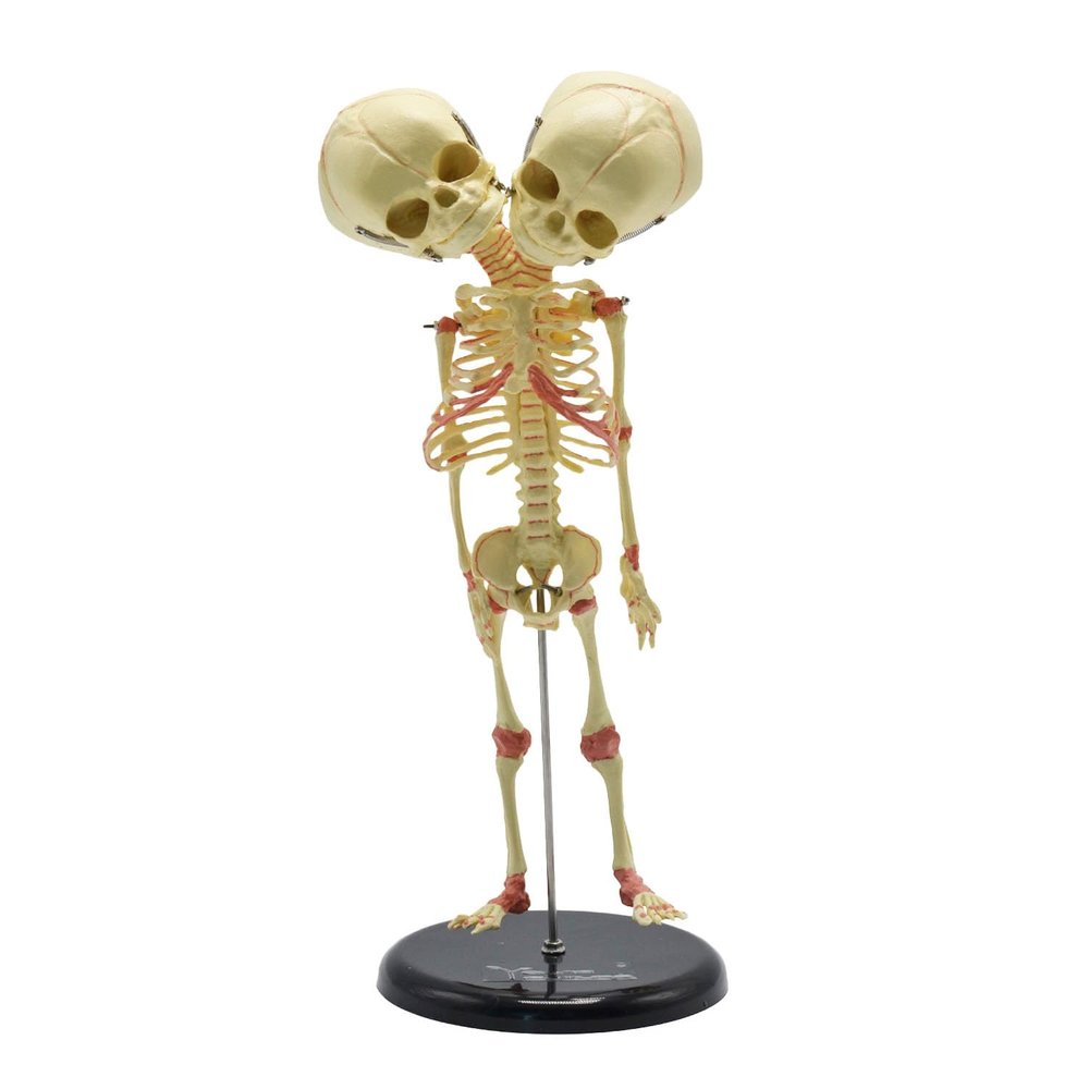 Abnormal fetal Skeleton of Infant Double-Headed Skeleton Model Used in Medical School Teaching