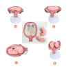 1st-7th Month Pregnancy Model Kit  Life-Size Embryo Set with Twin Option, 7 Stages Medical Education Uterus Display view 3