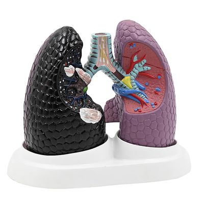 4D Lung Anatomical Model, Human Lung Model with Anti-Slip Base, High Simulation and Removable Design, Detachable Parts and Easy to Carry & Display, for Respiratory Study and Teaching Display