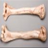 Aged Humerus Bones Left and Right view 1