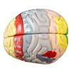2 Times Life-Size Brain Anatomical Model Color-Coded Human Regiona Brain 4 Parts Detachable Medical Brain Supplement Model Brain Neuroscience Teaching Medical Display Model view 3
