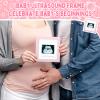13 Pcs New Mom Gifts for Girls Baby Shower Basket Gift Pregnancy New Parents Basket Gift for Couples Gender Reveal Gifts with Mom and Dad Baby Showers Care Package for First Time Moms view 4