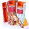 14 X Blood Vessel Anatomical Model, Human Artery Anatomy Model,Cardiovascular Model,Arteriovenous Cardiovascular Model,Anatomical Vessel Atherosclerosis Thbus Vascular Model view 2