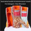 14 X Blood Vessel Anatomical Model, Human Artery Anatomy Model,Cardiovascular Model,Arteriovenous Cardiovascular Model,Anatomical Vessel Atherosclerosis Thbus Vascular Model view 3