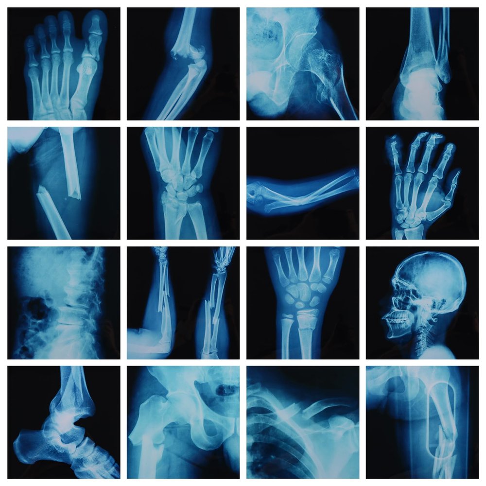 16Pcs Realistic Broken Bones X-Ray (9.8"x9.8") Skeleton X-Rays Human Skeleton Broken Bones PVC Plastic X-Ray Pretend Play Doctor Kit Learning Toy for Role-Playing Homeschooling School Supplies
