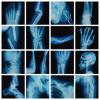 16Pcs Realistic Broken Bones X-Ray (9.8"x9.8") Skeleton X-Rays Human Skeleton Broken Bones PVC Plastic X-Ray Pretend Play Doctor Kit Learning Toy for Role-Playing Homeschooling School Supplies view 1