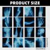 16Pcs Realistic Broken Bones X-Ray (9.8"x9.8") Skeleton X-Rays Human Skeleton Broken Bones PVC Plastic X-Ray Pretend Play Doctor Kit Learning Toy for Role-Playing Homeschooling School Supplies view 3
