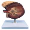 2 Times Magnification Human Kidney Anatomical Model, with Accurate Anatomy Structure & Clear Texture & Digital Labeled view 1