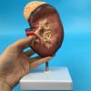 2 Times Magnification Human Kidney Anatomical Model, with Accurate Anatomy Structure & Clear Texture & Digital Labeled view 4