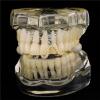 Gold Tooth Cap 5 PCS Gold Silver Color Glossy Wave Teeth Hip Hop Curve Zircon Tooth Caps For Teeth Mouth(Silver Zircon) view 3