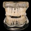 Gold Tooth Cap 10 PCS Hip Hop Vertical Bar Teeth Punk 14K Gold Plated Single Tooth Caps For Teeth Mouth(Rose Gold) view 4