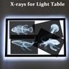 16 Animal X-Ray Set, Educational Science Kit for Kids to Explore Bone Structures for Lightstand Accessories, Light and Shadow Areas (Ocean Series) view 3