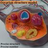 5X Magnified Female Uterus and Ovary Model,Realistic Female Reproductive System Anatomical Model,for Education Study Or Teaching,33X23X22Cm view 4