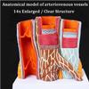 14 X Blood Vessel Anatomical Model, Anatomical Vessel Atherosclerosis Thbus Vascular Model, Human Artery Anatomy Model Cardiovascular Model for Science Education Teaching Model Display  view 4