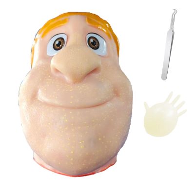 2026 New Refillable Pimple Popping Stress Relief Toy, Big Head Squeeze Toy for Stress & Anxiety Relief, Realistic Skin Blemish Press Toy for Teens & All Ages (Yellow)
