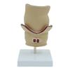 Human Rectal Pathological Anatomy Model, Internal and External Rectal Hemorrhoids Hemorrhoids lesions Model, Colon Anus Sphincter Specimen for Medical Research Teaching Display. view 2