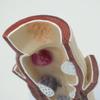 Human Rectal Pathological Anatomy Model, Internal and External Rectal Hemorrhoids Hemorrhoids lesions Model, Colon Anus Sphincter Specimen for Medical Research Teaching Display. view 4