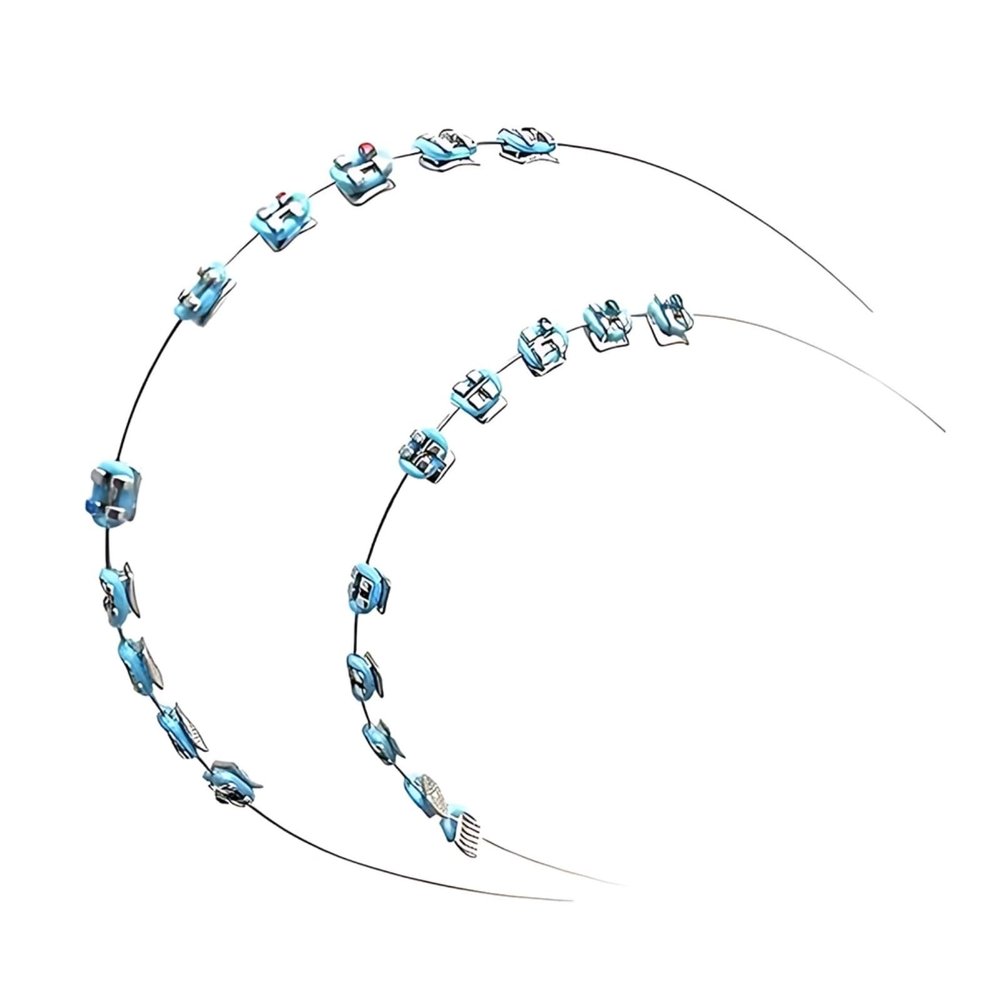 BOSREROY Costume Decorative Braces: Blue Fashion Metal Tooth