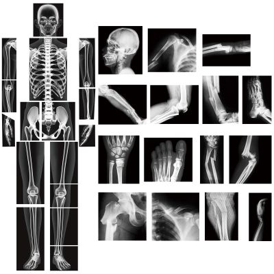 Novabright 31 Pcs Broken Human Bones x Ray Set for Kids Human X-Rays Skeleton Pretend Skeleton Pretend for Kids Body Display Play Table Educational Science Kits Black and White