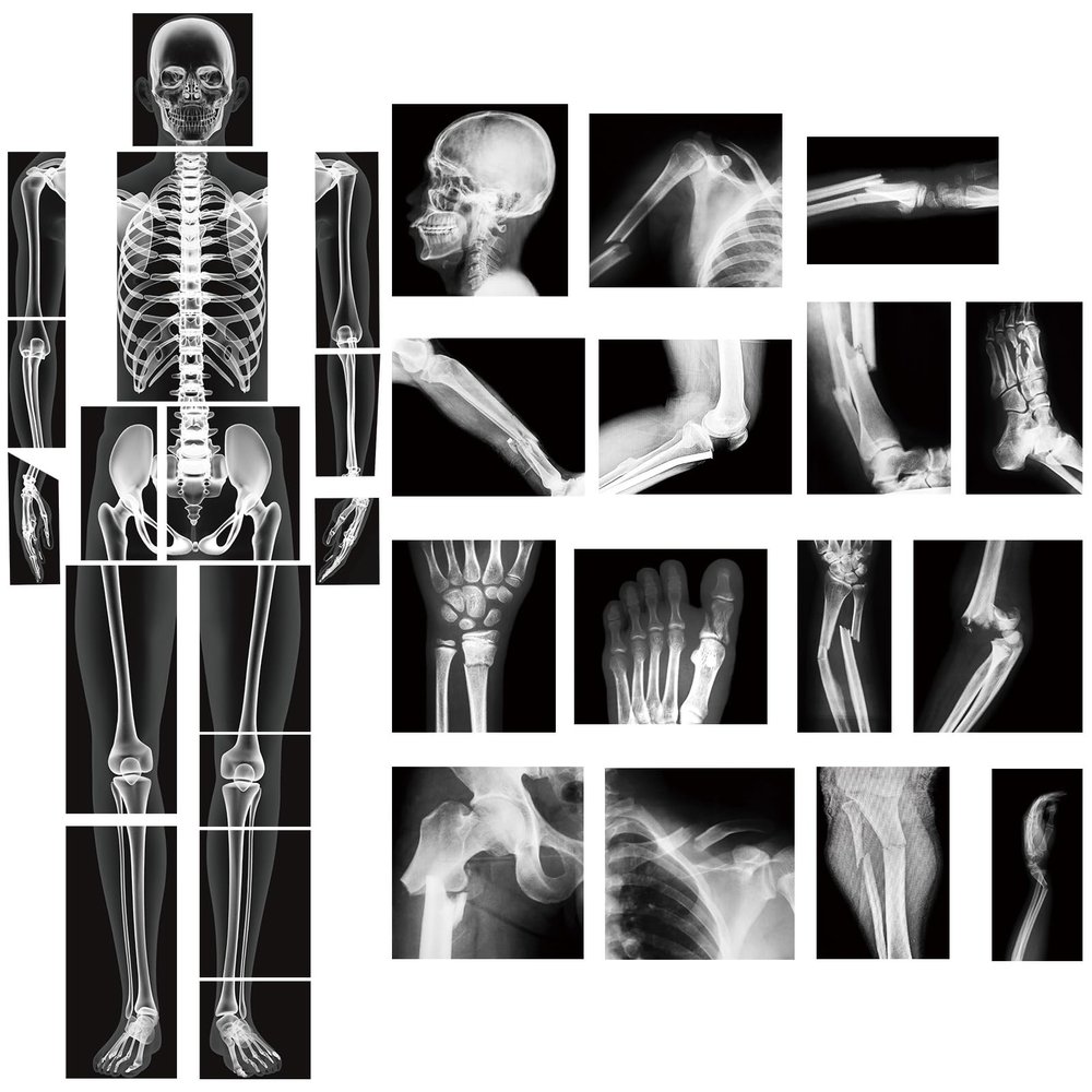Novabright 31 Pcs Broken Human Bones x Ray Set for Kids Human X-Rays Skeleton Pretend Skeleton Pretend for Kids Body Display Play Table Educational Science Kits Black and White