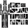 Novabright 31 Pcs Broken Human Bones x Ray Set for Kids Human X-Rays Skeleton Pretend Skeleton Pretend for Kids Body Display Play Table Educational Science Kits Black and White view 1