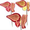 1:1 Life Size Human Prostate Anatomical Model | Normal & Pathological Prostate Model for Medical Education & Demonstration view 3